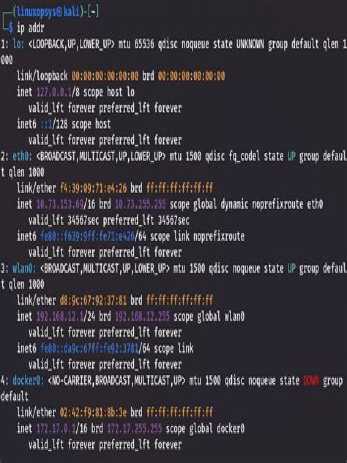 Where is my network interface Linux?